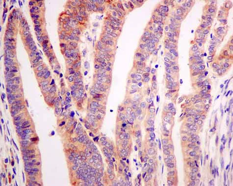 Immunohistochemistry (Formalin/PFA-fixed paraffin-embedded sections) - Anti-ARL 1 antibody [EPR10595] (AB155982)