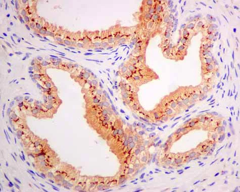 Immunohistochemistry (Formalin/PFA-fixed paraffin-embedded sections) - Anti-ARL 1 antibody [EPR10595] (AB155982)