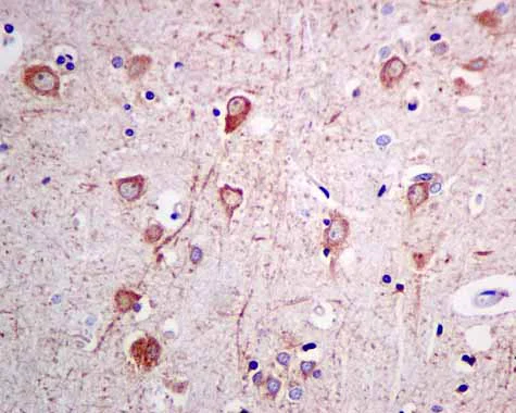 Immunohistochemistry (Formalin/PFA-fixed paraffin-embedded sections) - Anti-ARL 1 antibody [EPR10595] (AB155982)