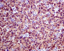 Immunohistochemistry (Formalin/PFA-fixed paraffin-embedded sections) - Anti-ARL 1 antibody [EPR10595] (AB155982)