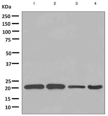 Western blot - Anti-ARL 1 antibody [EPR10595] (AB155982)