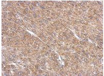 Immunohistochemistry (Formalin/PFA-fixed paraffin-embedded sections) - Anti-ARL13B antibody (AB153725), expandable thumbnail