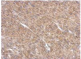 Immunohistochemistry (Formalin/PFA-fixed paraffin-embedded sections) - Anti-ARL13B antibody (AB153725)