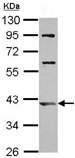 Western blot - Anti-ARL13B antibody (AB153725), expandable thumbnail
