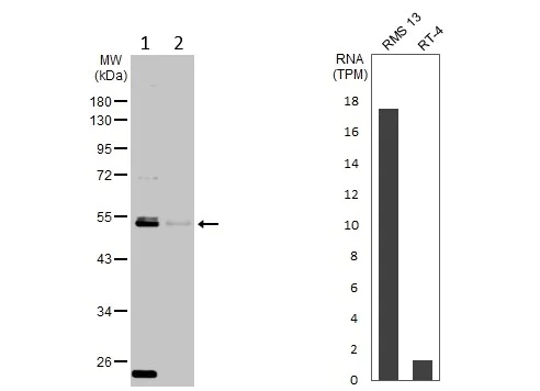 Western blot - Anti-ARL13B antibody (AB153725)