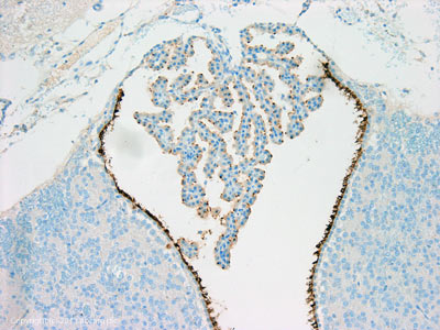 Immunohistochemistry (Formalin/PFA-fixed paraffin-embedded sections) - Anti-ARL13B antibody [N295B/66] (AB136648)
