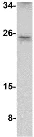 Western blot - Anti-ARL15 antibody (AB106441), expandable thumbnail