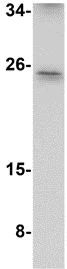 Western blot - Anti-ARL15 antibody (AB106441)