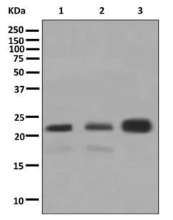 Western blot - Anti-ARL15 antibody [EPR12591] (AB178425)