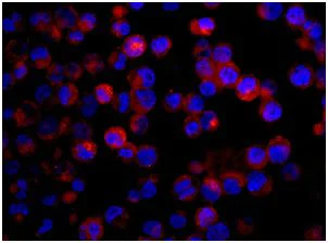 Immunocytochemistry/ Immunofluorescence - Anti-ARL15 antibody [EPR12591] - BSA and Azide free (AB236013)