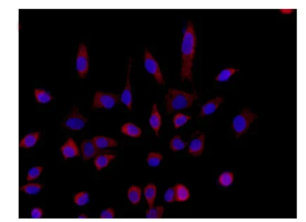 Immunocytochemistry/ Immunofluorescence - Anti-ARL2 antibody [EPR14436] (AB183510)