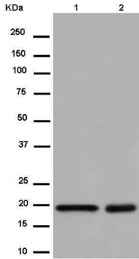 Western blot - Anti-ARL2 antibody [EPR14436] (AB183510)
