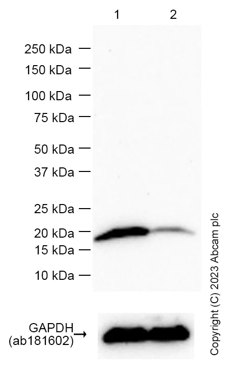 Western blot - Anti-ARL2 antibody [EPR14436] (AB183510)