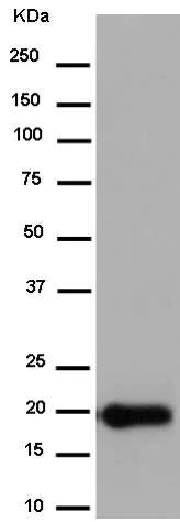 Western blot - Anti-ARL2 antibody [EPR14436] (AB183510)