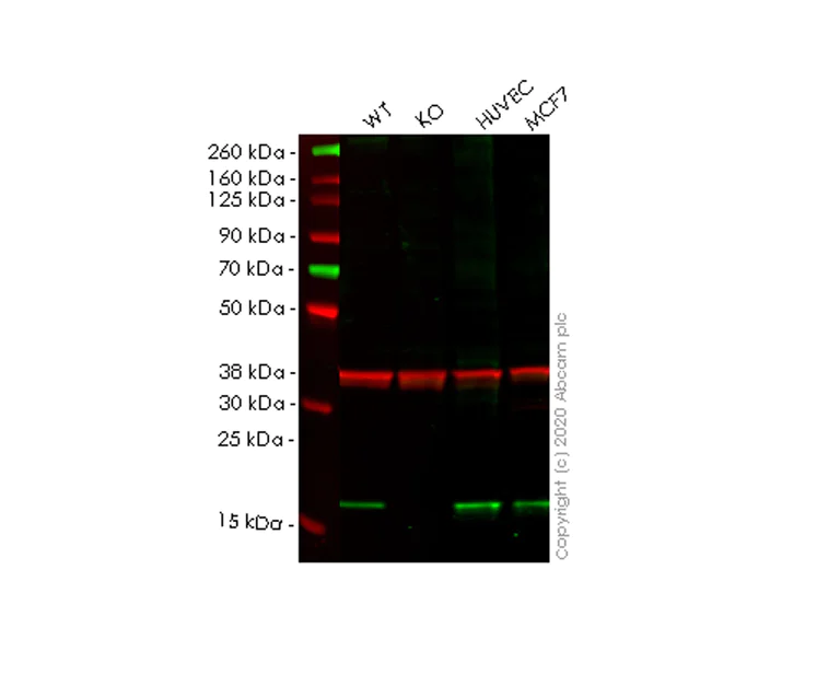 Western blot - Anti-ARL2BP antibody [EPR15265] (AB185964)