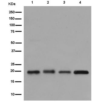 Western blot - Anti-ARL2BP antibody [EPR15265] (AB185964)