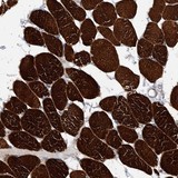 Immunohistochemistry (Formalin/PFA-fixed paraffin-embedded sections) - Anti-ARL4C antibody (AB122025), expandable thumbnail