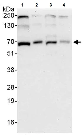 Western blot - Anti-ARL6IP2 antibody (AB224825)