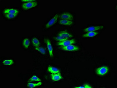 Immunocytochemistry/ Immunofluorescence - Anti-ARL6IP2 antibody (AB237631), expandable thumbnail