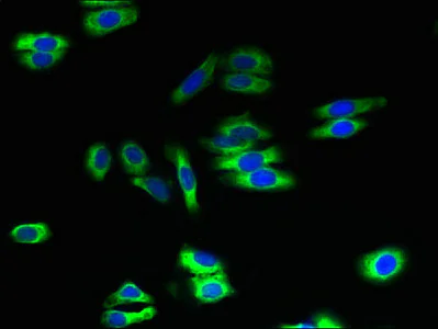 Immunocytochemistry/ Immunofluorescence - Anti-ARL6IP2 antibody (AB237631)