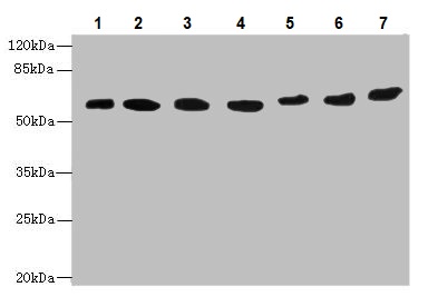 Western blot - Anti-ARL6IP2 antibody (AB237631), expandable thumbnail