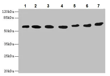 Western blot - Anti-ARL6IP2 antibody (AB237631)