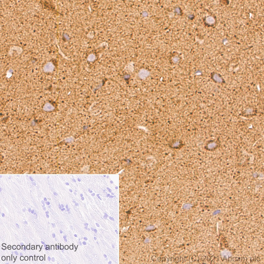 Immunohistochemistry (Formalin/PFA-fixed paraffin-embedded sections) - Anti-ARL8A antibody [EPR24376-2] (ab270979), expandable thumbnail