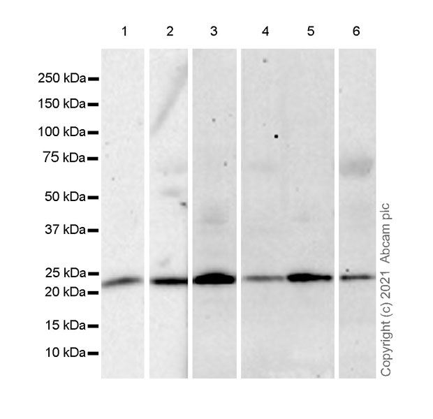 Western blot - Anti-ARL8A antibody [EPR24376-2] (AB270979), expandable thumbnail