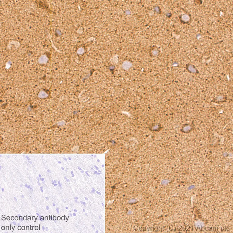 Immunohistochemistry (Formalin/PFA-fixed paraffin-embedded sections) - Anti-ARL8A antibody [EPR24376-2] - BSA and Azide free (AB282020)