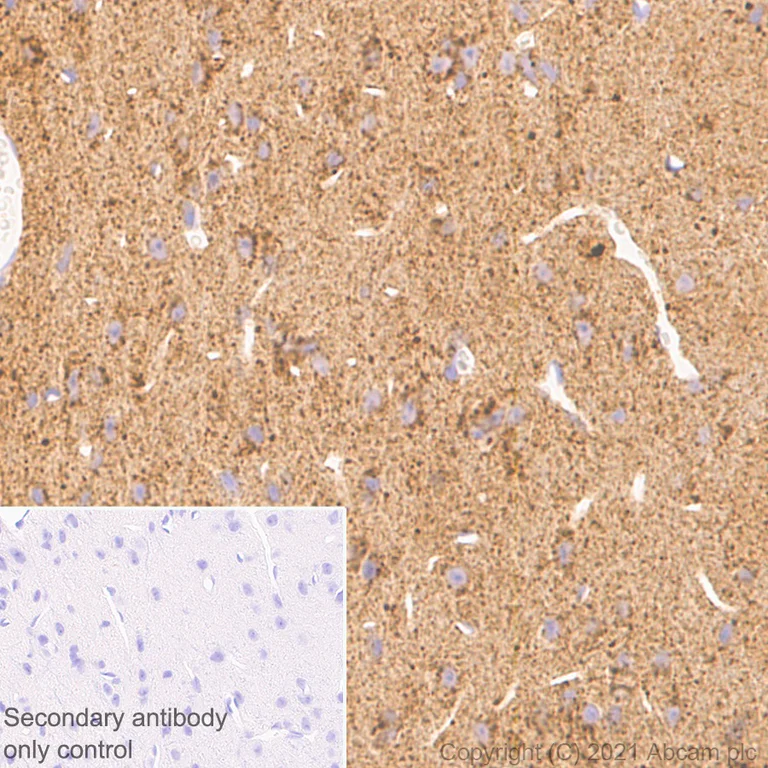 Immunohistochemistry (Formalin/PFA-fixed paraffin-embedded sections) - Anti-ARL8A antibody [EPR24376-2] - BSA and Azide free (AB282020)