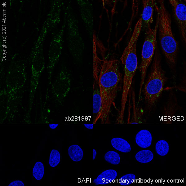 Immunocytochemistry/ Immunofluorescence - Anti-ARL8A + ARL8B antibody [EPR24376-103] - BSA and Azide free (AB282030), expandable thumbnail