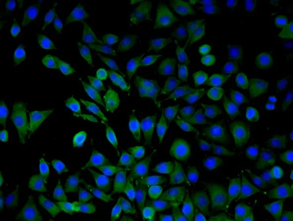 Immunocytochemistry/ Immunofluorescence - Anti-ARMC3 antibody (AB213161)