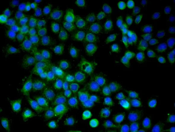Immunocytochemistry/ Immunofluorescence - Anti-ARMC3 antibody (AB213161)