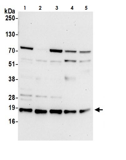 Western blot - Anti-ARMET/ARP antibody (AB264402)