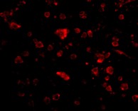 Immunocytochemistry/ Immunofluorescence - Anti-ARMET/ARP antibody (AB67271), expandable thumbnail