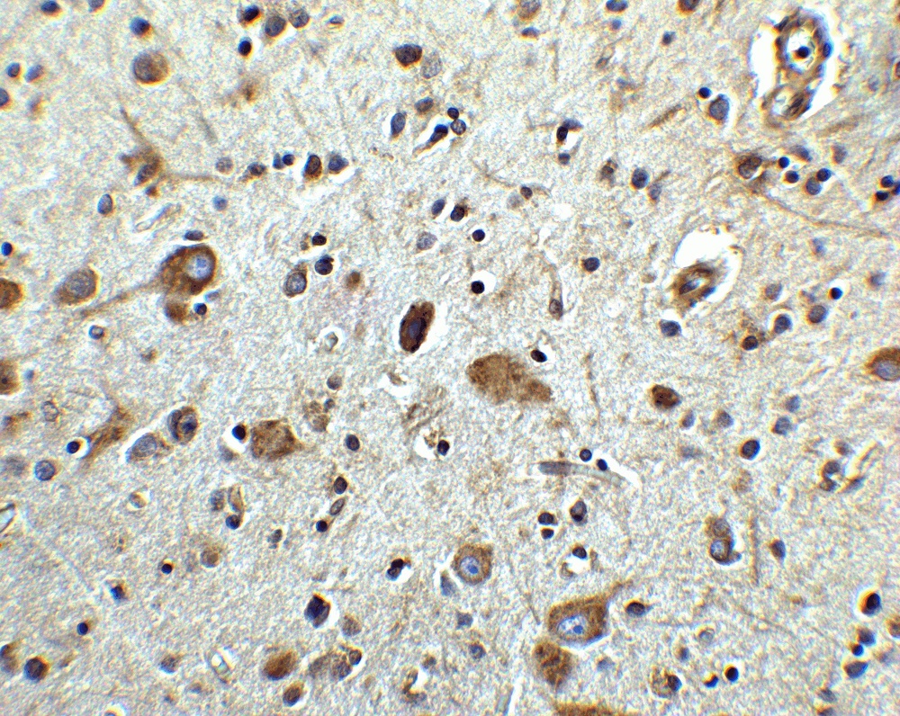 Immunohistochemistry (Formalin/PFA-fixed paraffin-embedded sections) - Anti-ARMET/ARP antibody (AB67271), expandable thumbnail