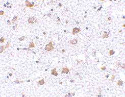 Immunohistochemistry (Formalin/PFA-fixed paraffin-embedded sections) - Anti-ARMET/ARP antibody (AB67271), expandable thumbnail