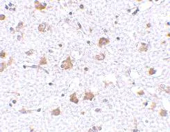 Immunohistochemistry (Formalin/PFA-fixed paraffin-embedded sections) - Anti-ARMET/ARP antibody (AB67271)