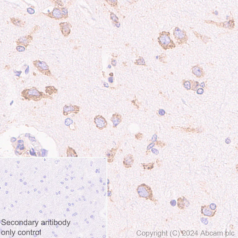 Immunohistochemistry (Formalin/PFA-fixed paraffin-embedded sections) - Anti-ARMET/ARP antibody [EPR29115-74] (AB316935)