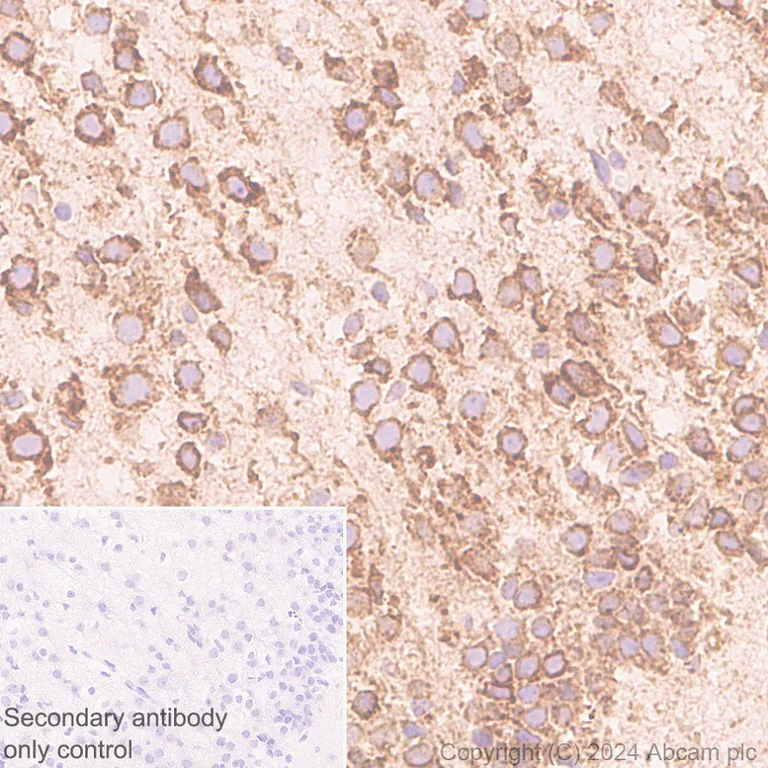 Immunohistochemistry (Formalin/PFA-fixed paraffin-embedded sections) - Anti-ARMET/ARP antibody [EPR29115-74] (AB316935)