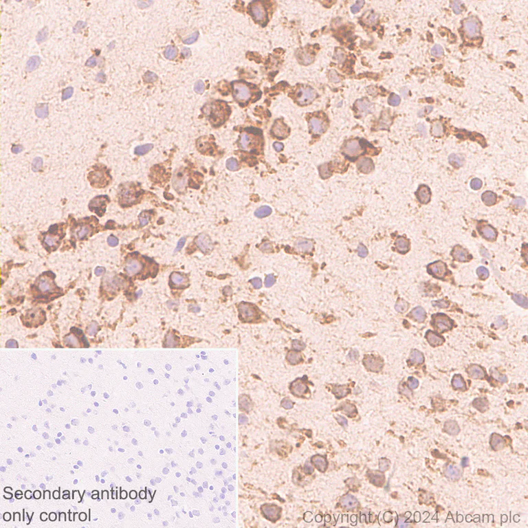 Immunohistochemistry (Formalin/PFA-fixed paraffin-embedded sections) - Anti-ARMET/ARP antibody [EPR29115-74] (AB316935)
