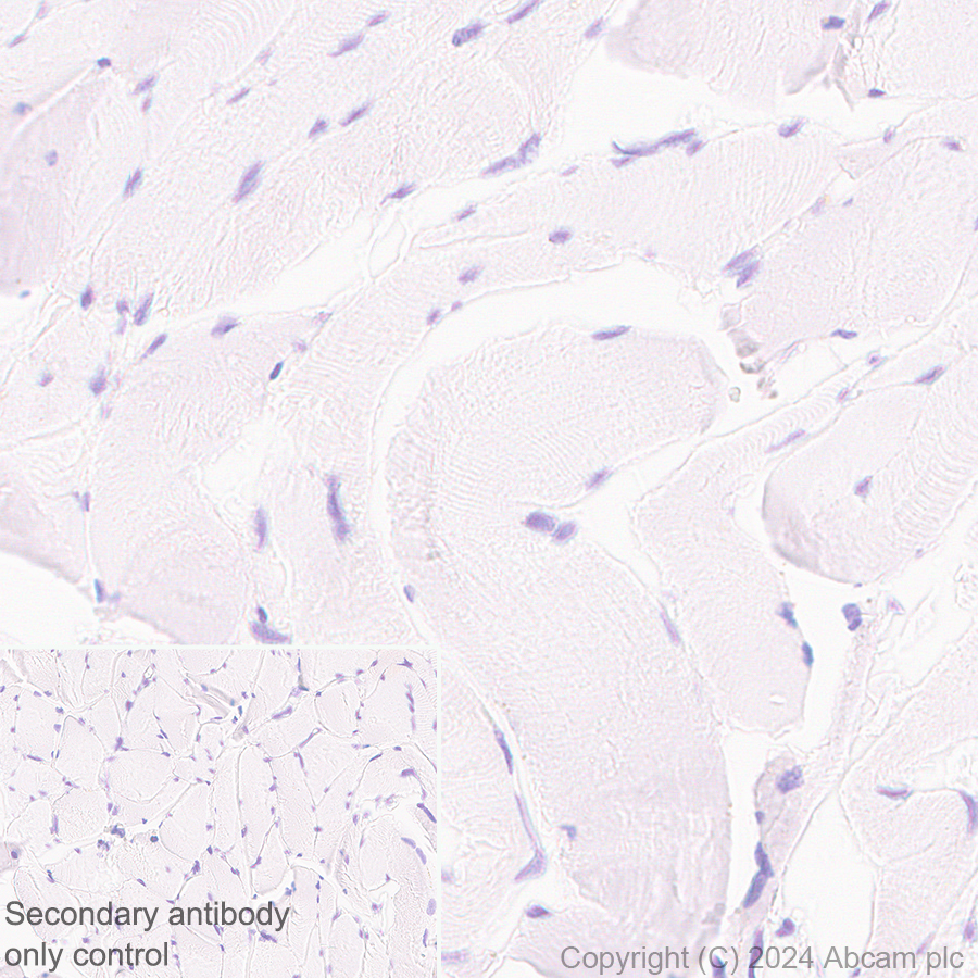 Immunohistochemistry (Formalin/PFA-fixed paraffin-embedded sections) - Anti-ARMET/ARP antibody [EPR29115-74] (AB316935)