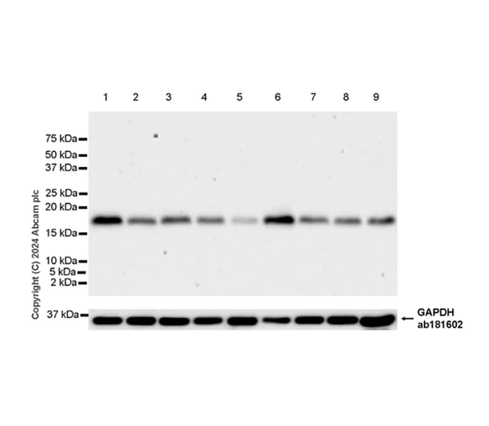 Western blot - Anti-ARMET/ARP antibody [EPR29115-74] (AB316935)