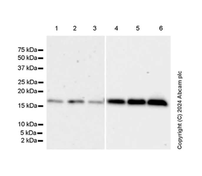 Western blot - Anti-ARMET/ARP antibody [EPR29115-74] (AB316935)