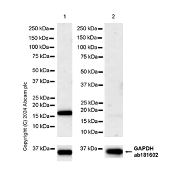 Western blot - Anti-ARMET/ARP antibody [EPR29115-74] (AB316935)