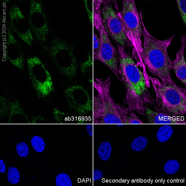 Immunocytochemistry/ Immunofluorescence - Anti-ARMET/ARP antibody [EPR29115-74] - BSA and Azide free (AB316936)