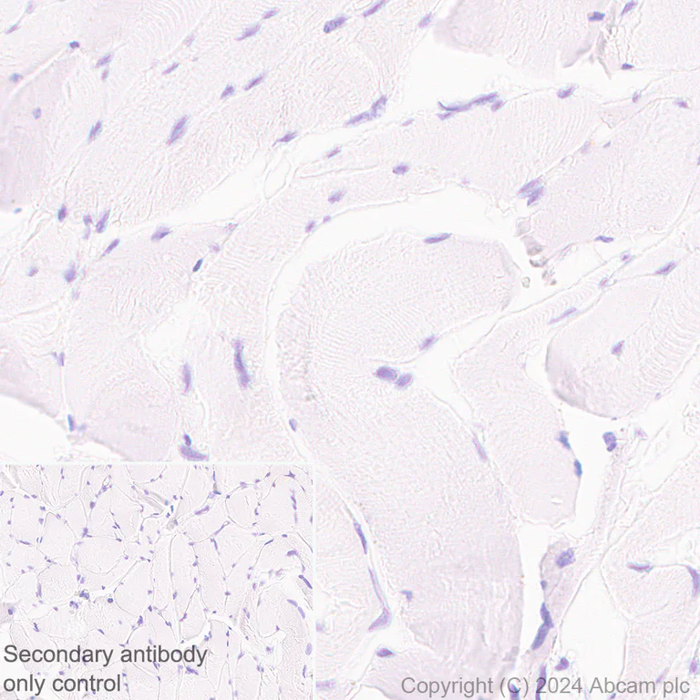 Immunohistochemistry (Formalin/PFA-fixed paraffin-embedded sections) - Anti-ARMET/ARP antibody [EPR29115-74] - BSA and Azide free (AB316936)