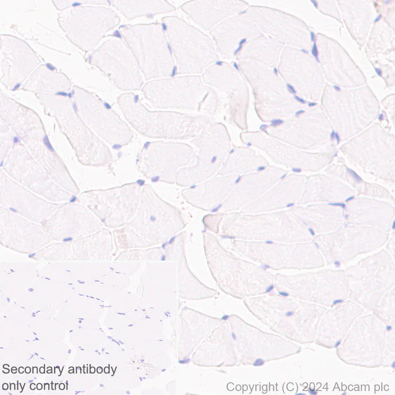 Immunohistochemistry (Formalin/PFA-fixed paraffin-embedded sections) - Anti-ARMET/ARP antibody [EPR29115-74] - BSA and Azide free (AB316936)