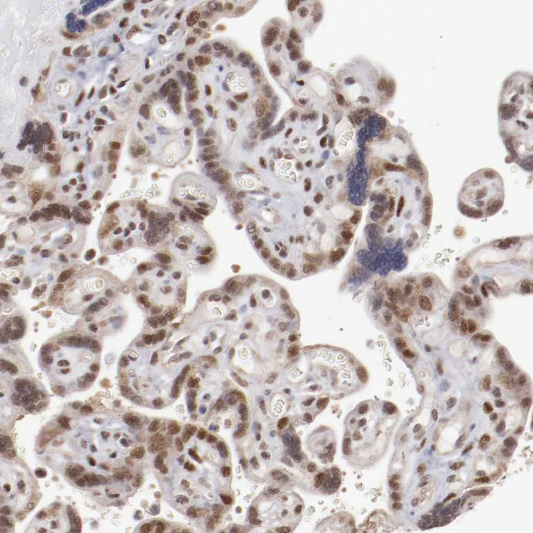 Immunohistochemistry (Formalin/PFA-fixed paraffin-embedded sections) - Anti-ARNT Antibody (AB327170)