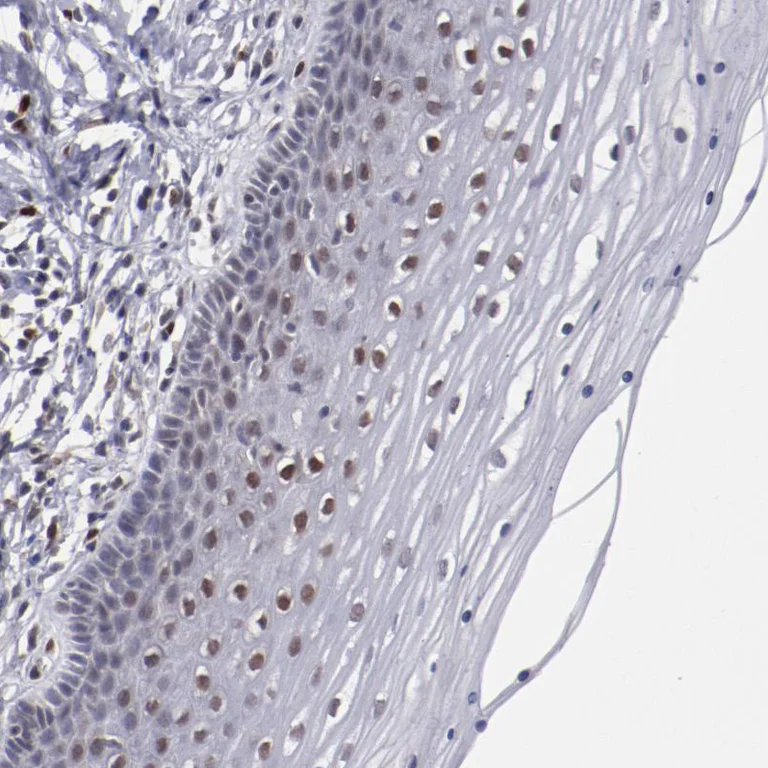 Immunohistochemistry (Formalin/PFA-fixed paraffin-embedded sections) - Anti-ARNT Antibody (AB327170)